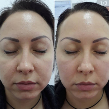 Авторський масаж обличчя
                    Салон красоты Body and face sculpture Киев