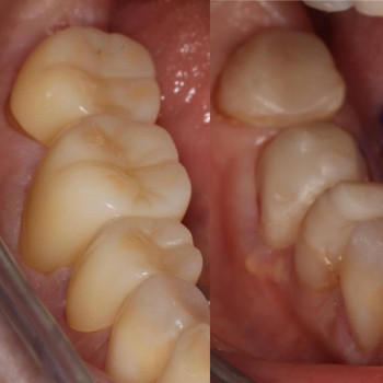 Вадим Гаєцький, Житомир Фото - 5