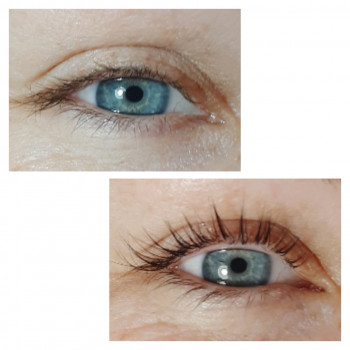 Ламинирование ресниц
                    Мастер депиляции Юлия Вышгород