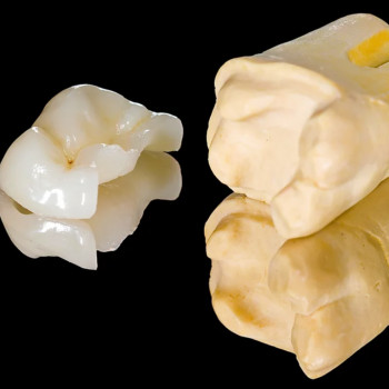 композитна вкладка 2