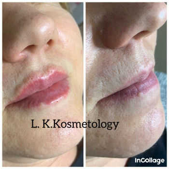 Лариса Петрівна, Луцьк Фото - 98