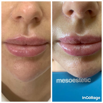 Лариса Петрівна, Луцьк Фото - 99