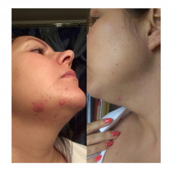 Людмила Чайка, Київ Фото - 5