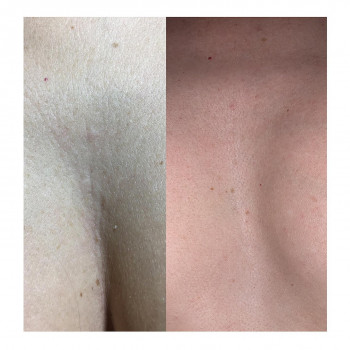 Людмила Чайка, Київ Фото - 3