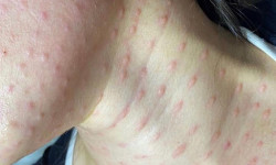 Биорепарация Косметолог Анастасия Одеса