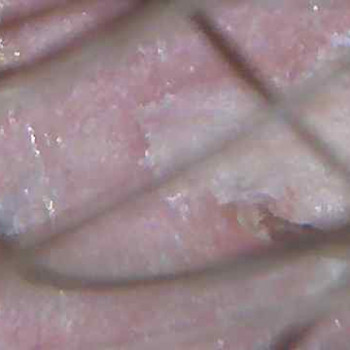 апаратна косметологія обличчя