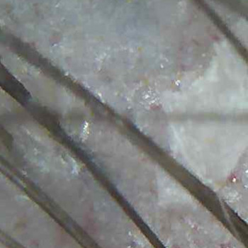 апаратна косметологія обличчя