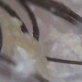 Детокс/Пілінг шкіри голови
                    Салон краси Vakaruk Keratin Studio Київ