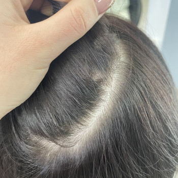 Детокс/Пілінг шкіри голови
                    Салон краси Vakaruk Keratin Studio Київ