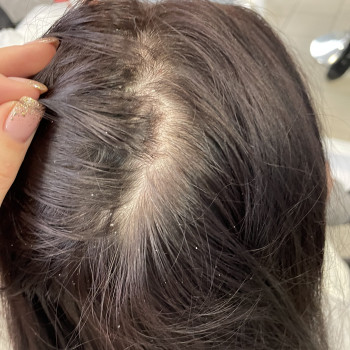 Детокс/Пілінг шкіри голови
                    Салон краси Vakaruk Keratin Studio Київ