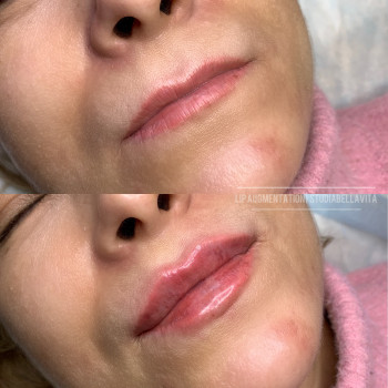 Bella Vita, Київ Фото - 4