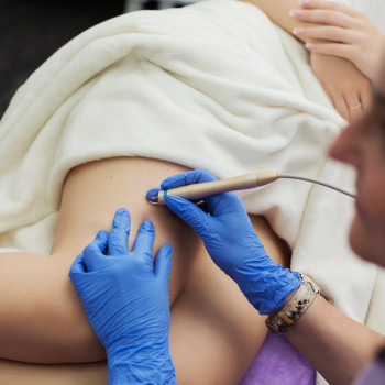 Удаление новообразований