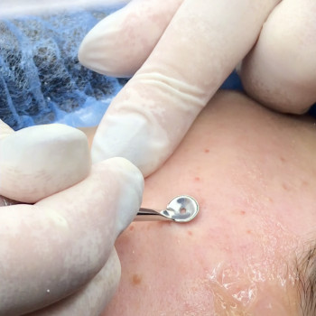 Наталья Косметология, Маріуполь Фото - 5