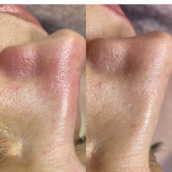 Аліна Томащук, Ивано-Франковск Фото - 8