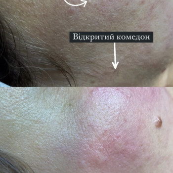 Аліна Томащук, Ивано-Франковск Фото - 14