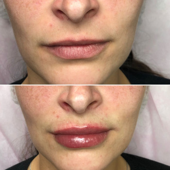 Анна Дзюба, Ужгород Фото - 25