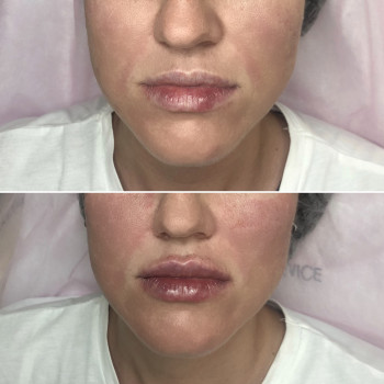 Анна Дзюба, Ужгород Фото - 27