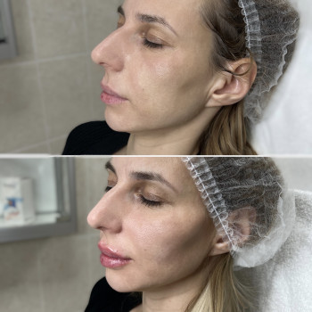 Анна Дзюба, Ужгород Фото - 33