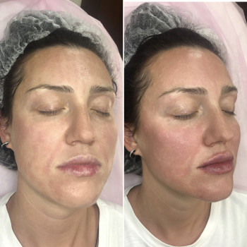 Анна Дзюба, Ужгород Фото - 35