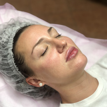 Увеличение губ, скул, подбородка, углов нижней челюсти, заполнение носогубных складок и морщин
                    Косметолог-инъекционист Анна Ужгород