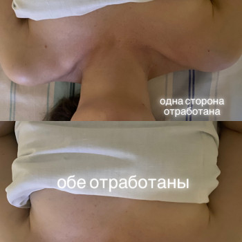 Авторский массаж зоны стресса.Результат виден после первой п