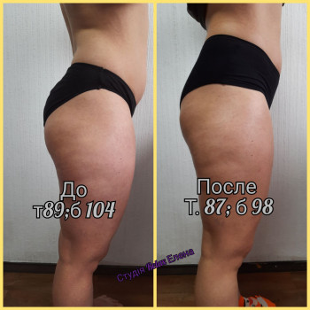 Елена Кнапик, Винница Фото - 11