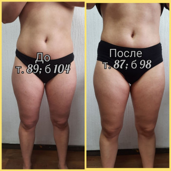 Елена Кнапик, Винница Фото - 12