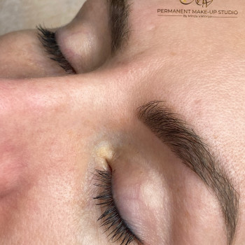 Зажившие брови