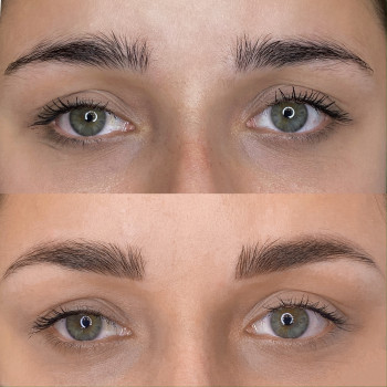 Заживші брови