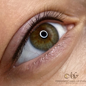 Міжвійна стрілочка