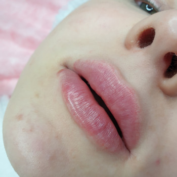 Увеличение губ
                    Майстер перманентного макіяжу Юлия Суми