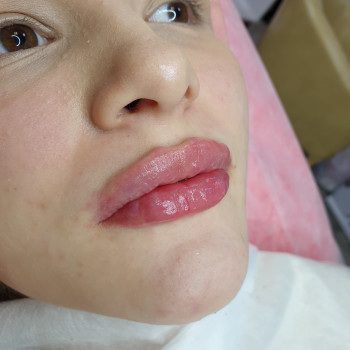 Увеличение губ
                    Майстер перманентного макіяжу Юлия Суми