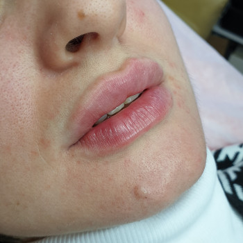 Увеличение губ
                    Майстер перманентного макіяжу Юлия Суми