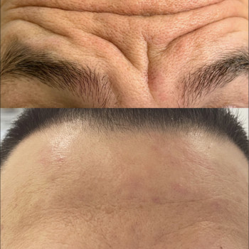 Ірина Бежан, Чернівці Фото - 1