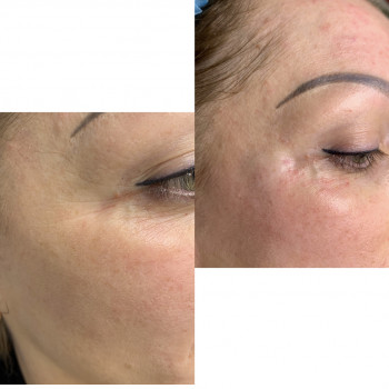 Ірина Бежан, Чернівці Фото - 7