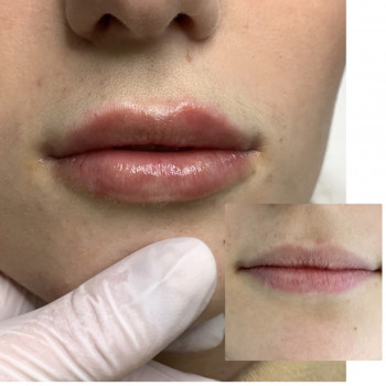 Ірина Бежан, Чернівці Фото - 8