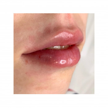 Ірина Бежан, Чернівці Фото - 9