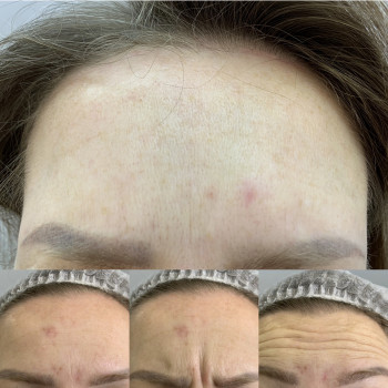 Ірина Бежан, Чернівці Фото - 10