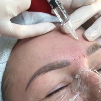 Ірина Бежан, Чернівці Фото - 11