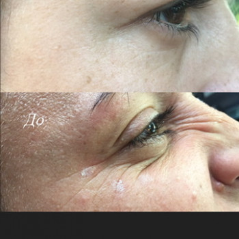 Бототерапія