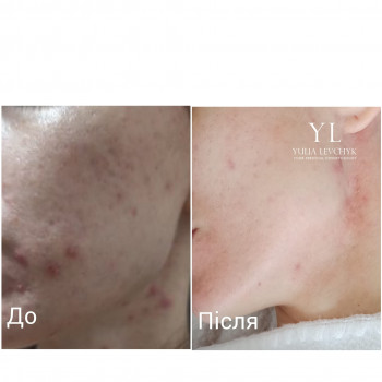 Юлія Левчик, Луцьк Фото - 7