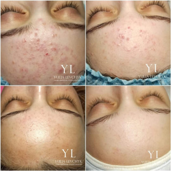 Юлія Левчик, Луцьк Фото - 8