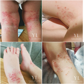 Юлія Левчик, Луцьк Фото - 9