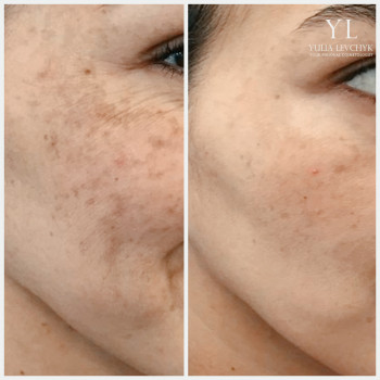 Юлія Левчик, Луцьк Фото - 10