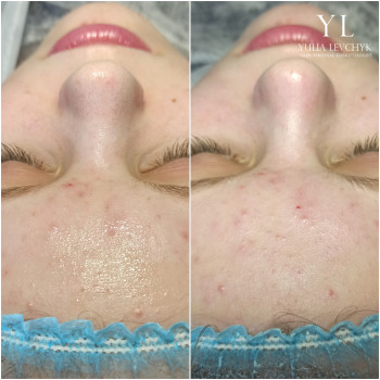 Юлія Левчик, Луцьк Фото - 14