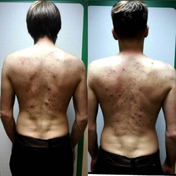 Микола Шимчишин, Київ Фото - 8