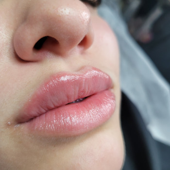 Збільшення губ
                    Салон краси MM Studio Тернопіль