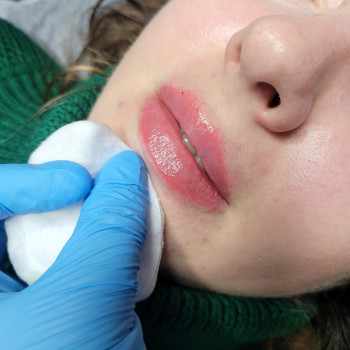 Збільшення губ
                    Салон краси MM Studio Тернопіль