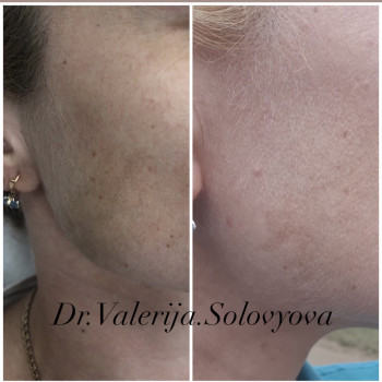 Валерія Соловйова, Ужгород Фото - 5