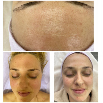 Валерія Соловйова, Ужгород Фото - 8